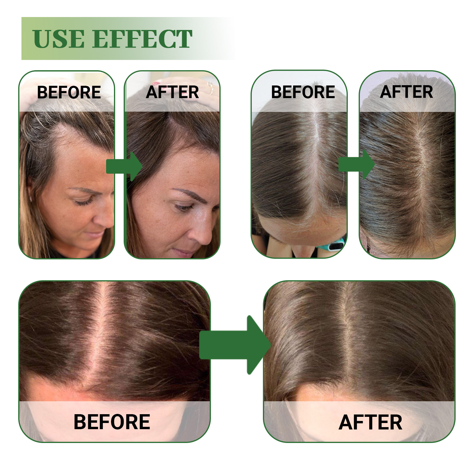 Hoegoa Rosemary Hair Repair Oi - Hair Care For Curly Dry Hair บทวิจารณ์และราคา