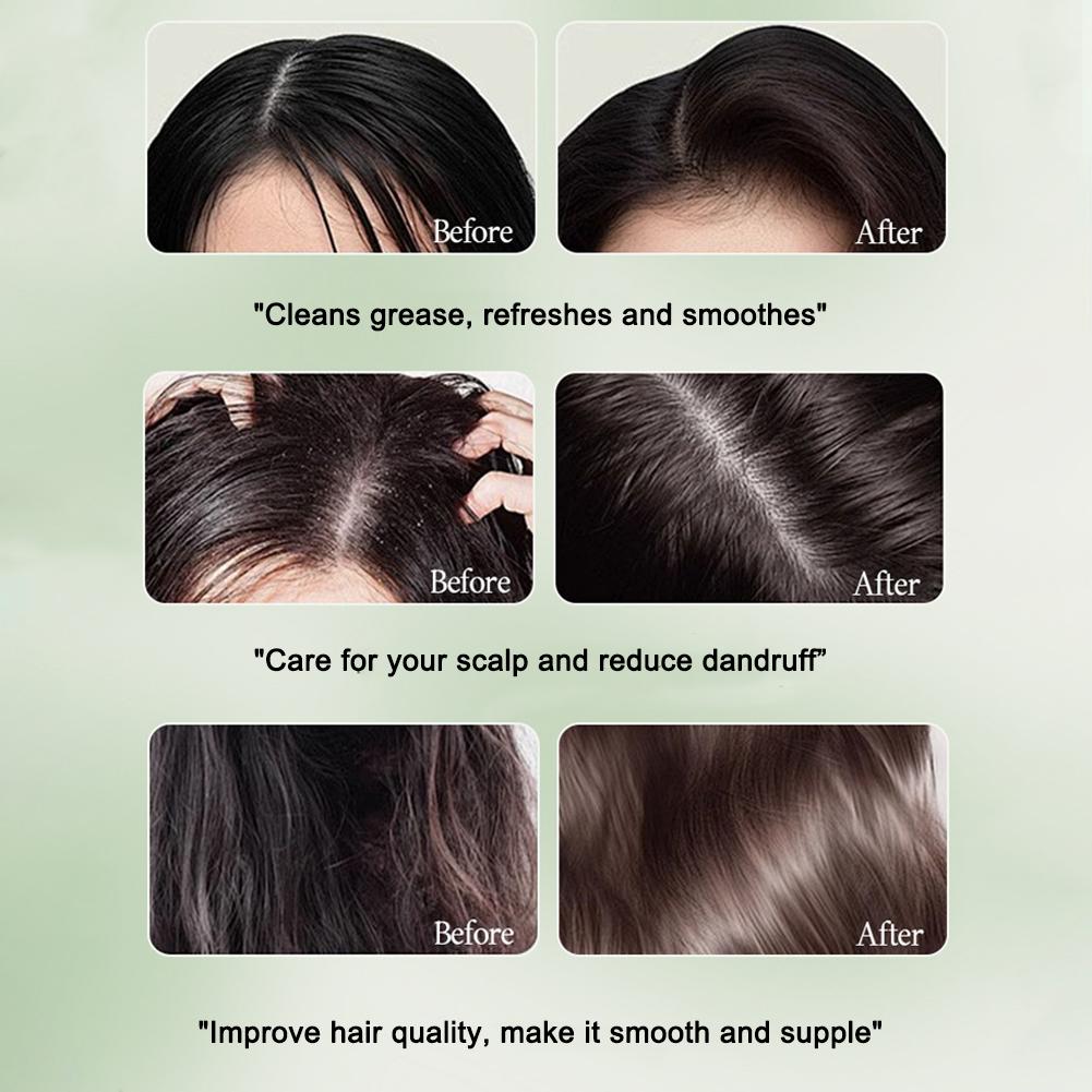 1-10Pcs Natural Herbal Shampoo - Hair Care Tonic บทวิจารณ์และราคา