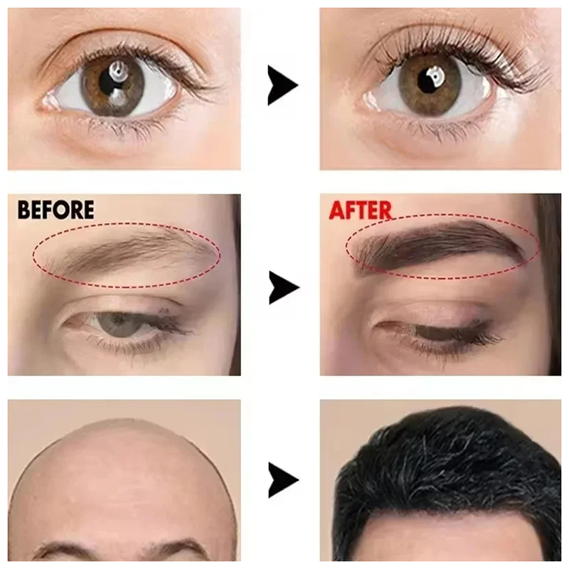 Fast Eyebrow Growth Serum Eyel - Hair Care Tonic บทวิจารณ์และราคา